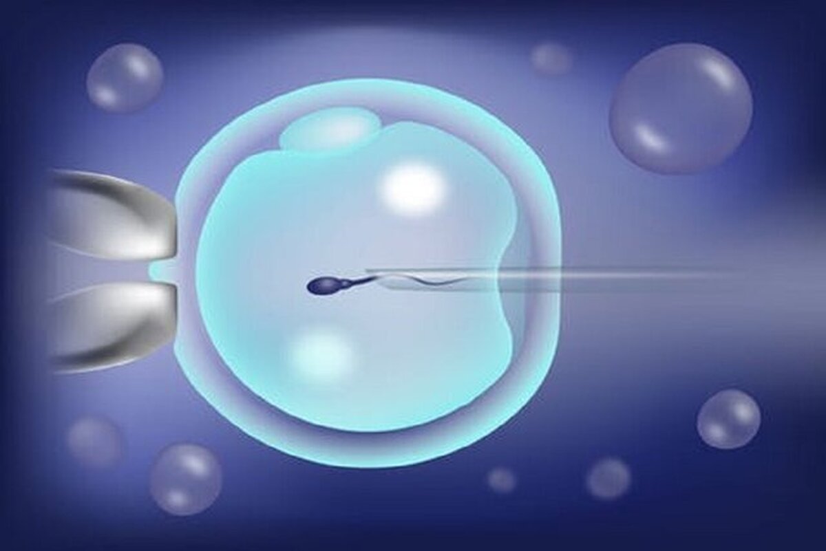 مشکلات ناباروری چندین زوج را درگیر کرده است؟