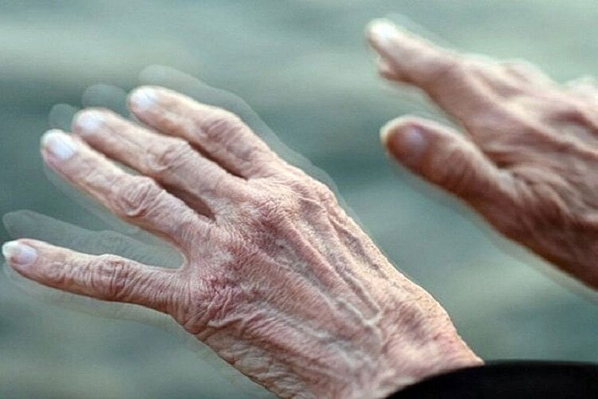 مبارزه با بیماری پارکینسون به بهترین نقطه رسید!