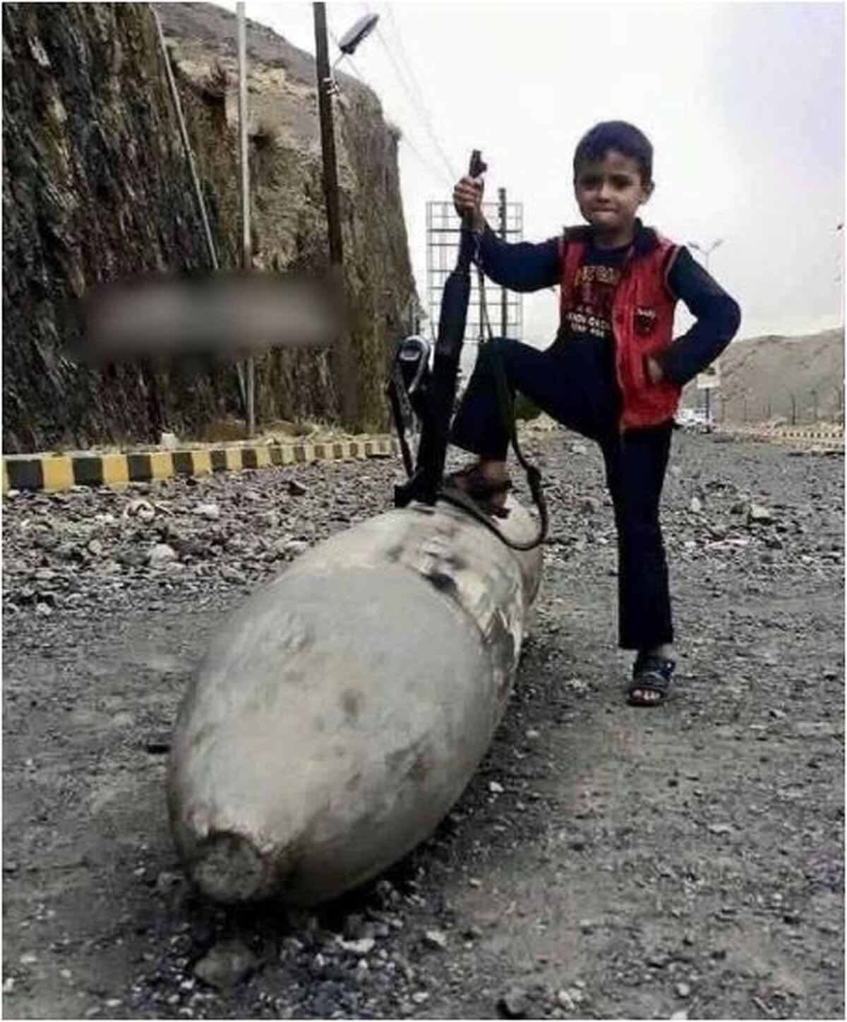 تصویر جالب از فیگور کودک یمنی دنیا را تکان داد