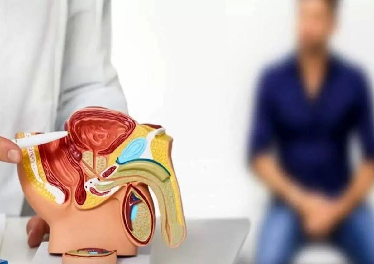 راهکار‌های خانگی و کم هزینه برای جلوگیری از سرطان پروستات