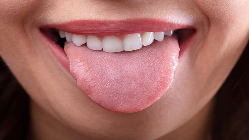 تغییر رنگ زبان درمورد سلامت شما چه می‌گوید؟/ آیا راهی برای رفع زردی زبان هست؟