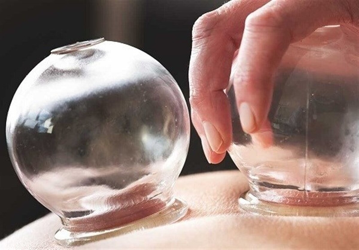 حجامت در طب سنتی ایرانی چه جایگاهی دارد؟