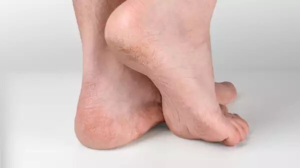 درد در نقاط مختلف پا نشانه چیست؟ سردی دائم پا‌ها چطور؟