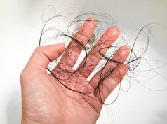 مزوتراپی و PRP  روشی جدید و اثر بخش برای تقویت موی سر و ابرو