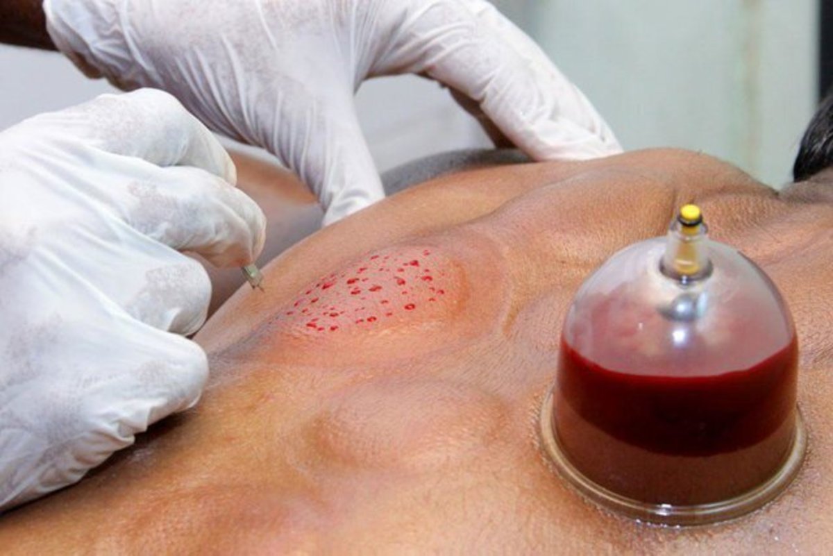 برخورد قاطع با مداخله‌گر طب سنتی در نیشابور