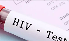 HIV همان ایدز است؟ این بیماری درمان طبیعی دارد؟