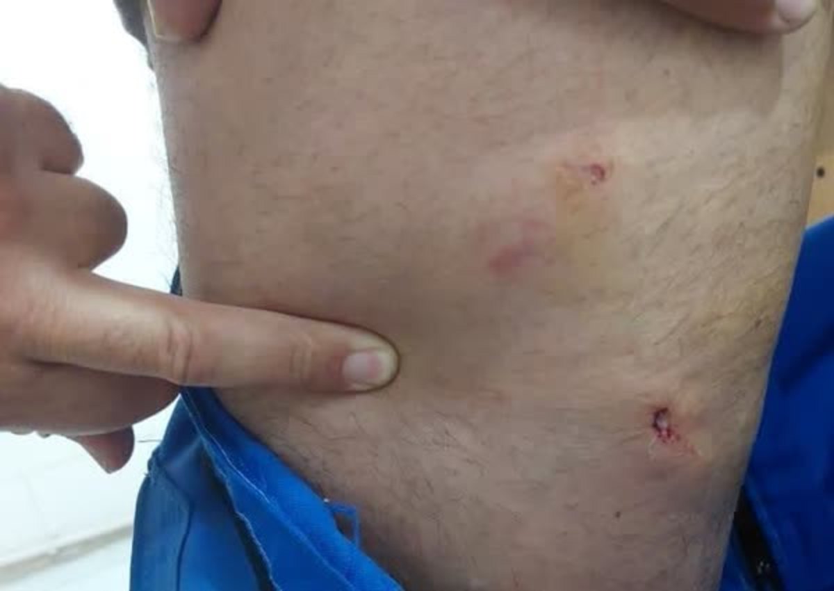 گزش وا‌کسیناتور دامپزشکی توسط سگ در نیشابور