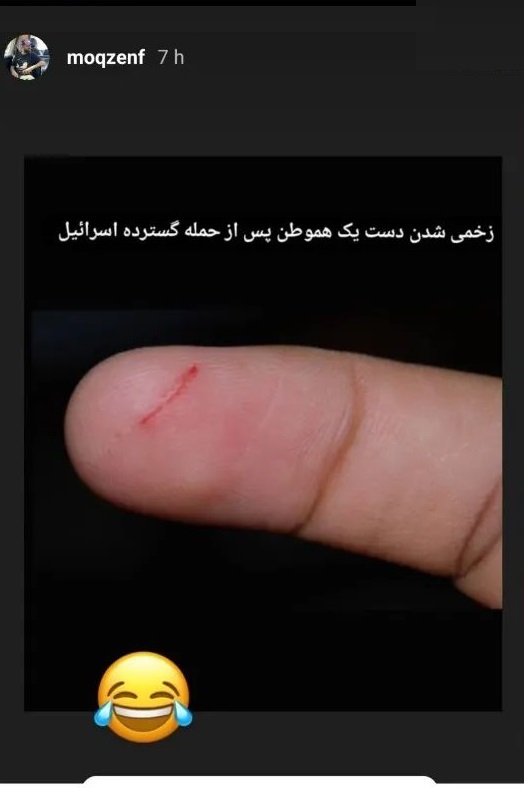 محسن افشانی از زخمی شدن یک شهروند طی حادثه صبح روز جمعه در اصفهان خبر داد! /از خنده میمیری