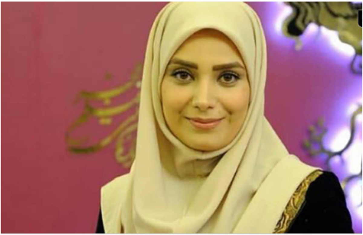 چهره جدید خانم مجری بعد از عمل‌های جدیدش دیگر قابل شناسایی نیست! /عکس