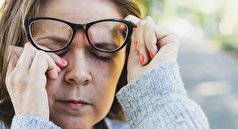 چند دلیل برای پریدن پلک چشم راست + نشانه‌ها