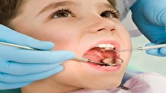شاخص پوسیدگی دندان کودکان در خراسان‌شمالی پایین‌تر از میانگین کشوری است