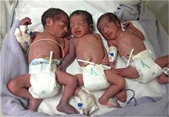 تولد سه قلو‌ها در بیمارستان شهید بهشتی کاشان