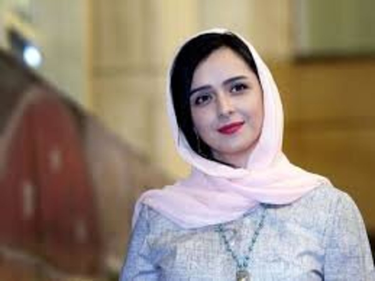 سندروم عجیبی که ترانه علیدوستی به آن مبتلا شد