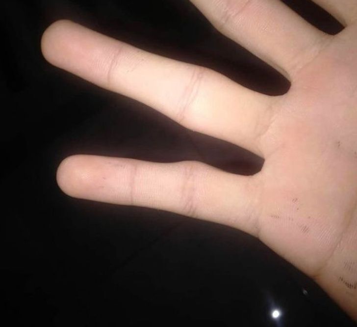 به خاطر این ۷ دلیل از گوشی هوشمند طولانی مدت استفاده نکنید