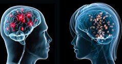 کشف تفاوت‌های پنهان مغز زنان و مردان توسط هوش‌مصنوعی