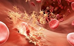 نقش مهم پلاکت خون در جلوگیری از خونریزی