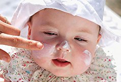 اهمیت مراقبت از پوست کودکان در برابر آفتاب