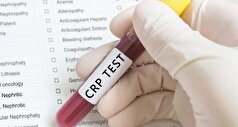 هر آنچه که باید درمورد آزمایش CRP و دلایل انجام آن بدانید