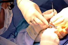 برای اولین بار عمل جراحی ترمیم عصب حسی انگشت دست در بیمارستان امام حسین علیه‌السلام انجام شددست