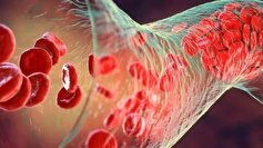 مشاهده میکروپلاستیک‌ها در لخته‌های خونی!