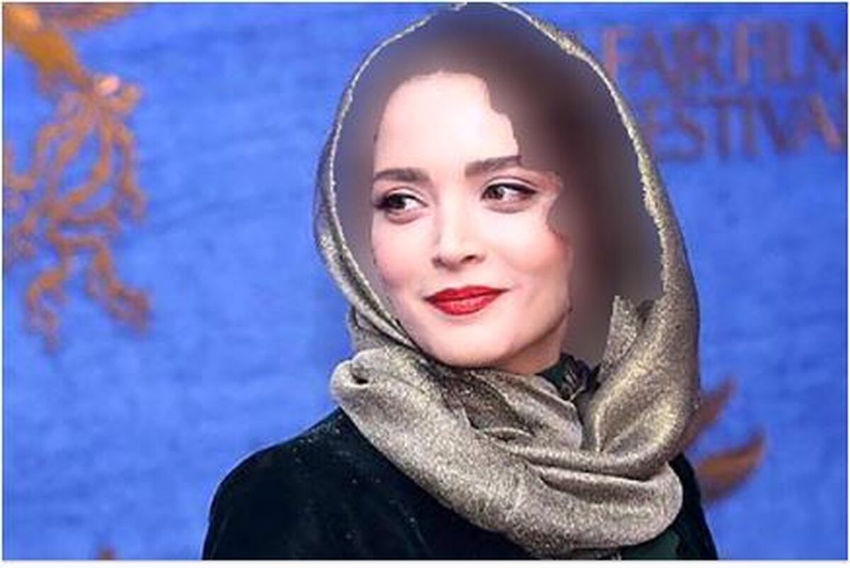 بهنوش طباطبایی چی بود و چی شد؟ /معجزه عمل‌های زیبایی برای خانم بازیگر