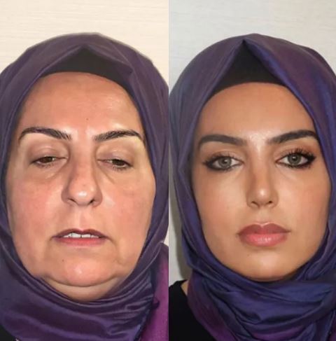 یک کلینیک زیبایی در ترکیه که معجزه می‌کند!