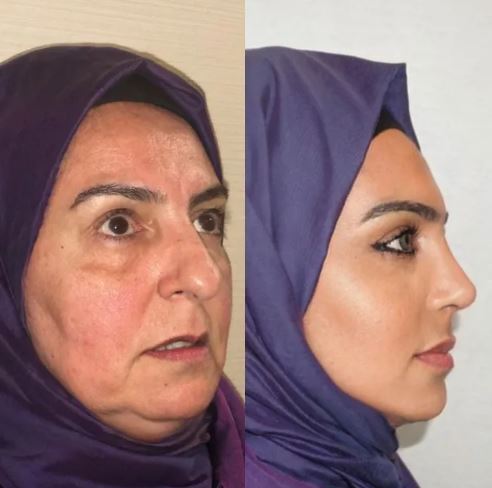 یک کلینیک زیبایی در ترکیه که معجزه می‌کند!