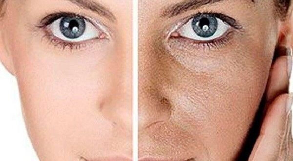 کار‌هایی که برای داشتن یک پوست صاف و جوان باید انجام دهید