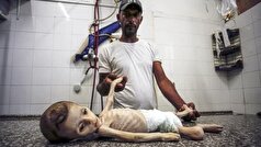 گرسنگی و سوءتغذیه جان هزاران کودک را در غزه تهدید می‌کند
