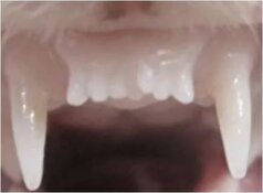 آزمایش‌های انسانی برای رویش دوباره دندان‌ها آغاز می‌شود