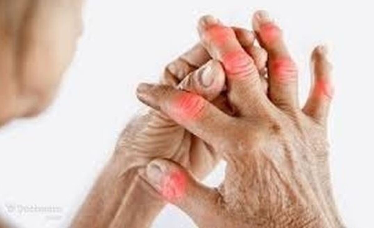 آرتروز کدام قسمت‌های بدن را درگیر میکند؟