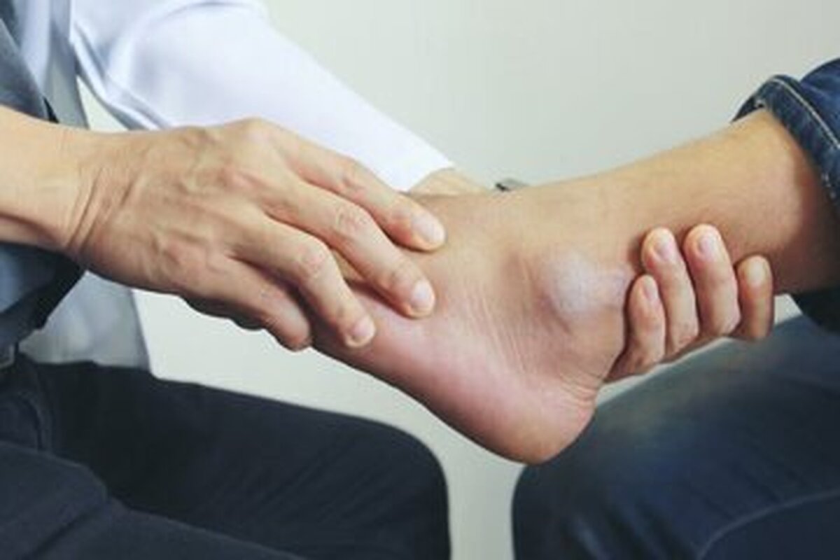 پا‌های خشک و ترک خورده و زخم روی پا از جمله علائم هشدار دهنده پای دیابتی است