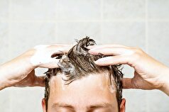 درمان شپش و رفع شوره با شستن مو با تاید