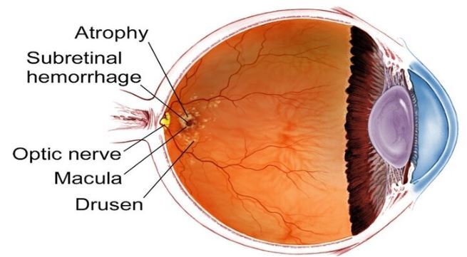 مصرف ملاتونین سلامت چشم را در دوران سالمندی تضمین می‌کند