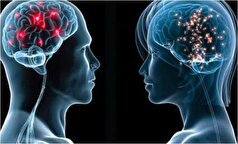 چه تفاوتی بین مغز مردان و زنان وجود دارد؟