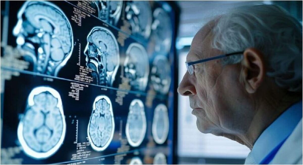 با این دارو، روند مبتلا شدن به آلزایمر به تعویق می‌افتد