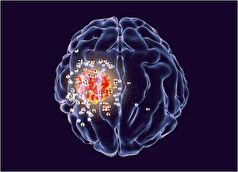 اشعه ایکس در مقادیر پایین توانایی از بین بردن سلول‌های تومور مغزی را دارد