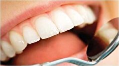 چگونه دندان‌های سالم و سفید داشته باشیم؟