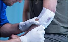 فناوری جدید در تولید پانسمان برای بهبودی سریع‌تر زخم‌ها