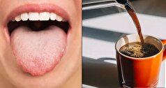 مصرف قهوه ترک‌ها و پوشش زرد ضخیم روی زبان را بیشتر می‌کند