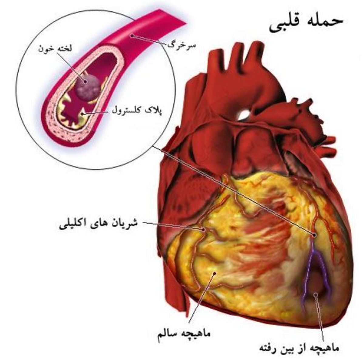 با علائم این دو مشکل بزرگ قلبی آشنا شوید!