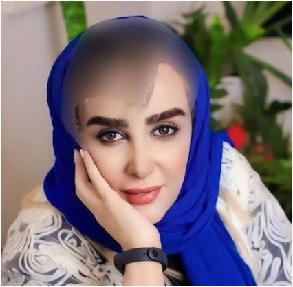 این خانم بازیگر ملکه عمل زیبایی ایران لقب گرفت! / شیوا خسرو مهر در پیری جوان و زیبا شد!