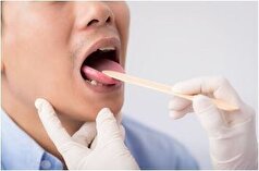 زبان کبود نشان دهنده چه بیماری‌هایی است؟