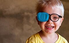 هوش مصنوعی به کمک روند درمان تنبلی چشم کودکان می‌آید!