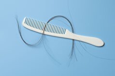 نازک شدن و در نهایت ریزش مو چه علتی میتواند داشته باشد؟