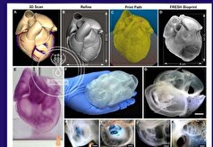 یک مدل سه بعدی از قلب یک بیمار به کمک جلبک دریایی!