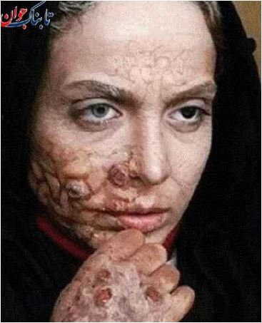 لیست کامل بازیگرانی که با گریم جذامی جلوی دوربین ظاهر شدند/ از المیرا دهقانی بازیگر سریال لحظه گرگ و میش تا... +عکس لیست کامل بازیگرانی که با گریم جذامی جلوی دوربین ظاهر شدند/ از المیرا دهقانی بازیگر سریال لحظه گرگ و میش تا... +عکس