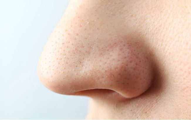 ۹ دلیل که باز شدن منافذ روی پوست بینی را توجیح می‌کند