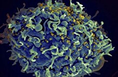 پیوند سلول‌های بنیادی این فرد مبتلا به ویروس HIV را نجات داد!
