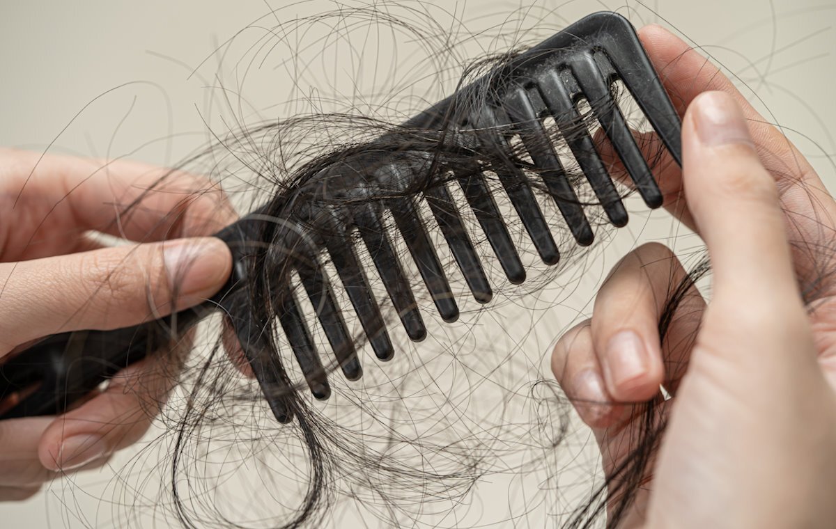 تا چه میزان ریزش مو برای زنان طبیعی است؟